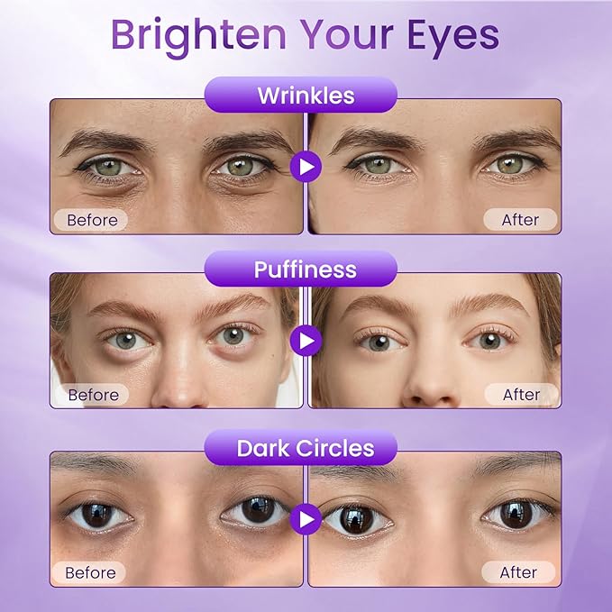 Eye Cream for Dark Circles and Puffiness, Hydrating Under Eye Cream for Dark Circles, Anti Aging Dark Circle Eye Cream for Fine Lines, Wrinkles, Firming Eye Contour, 1.06 oz-BH333