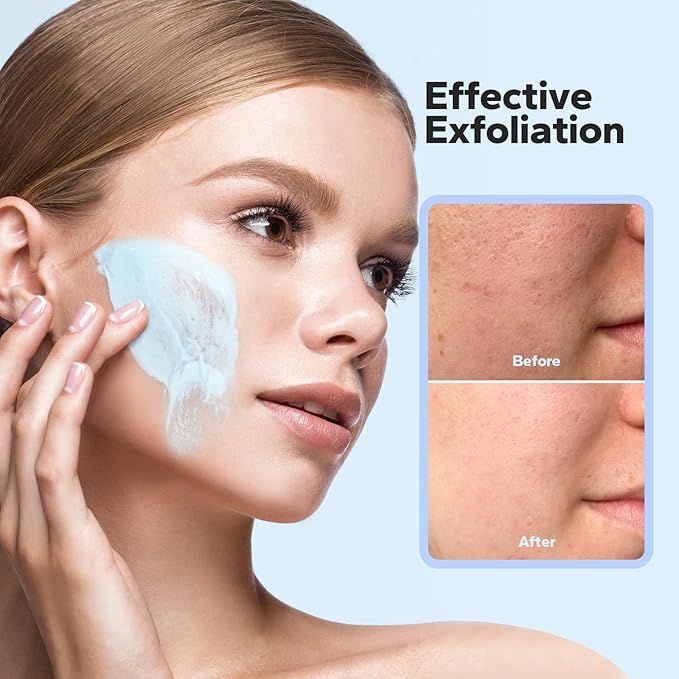 SilkySecret Face Exfoliator (4.23 Oz), Face Scrub, Microdermabrasion Facial Scrub Exfoliator with Natural Pumice, Peptides & Botanical Extracts, Facial Exfoliator for Smooth and Refreshed Skin