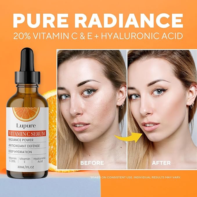Lupure Professional Vitamin C Face Serum 20%, Anti Aging Facial Super Vit C Serum with Ascorbic Acid Hyaluronic Acid & Vitamin E for Dark Spots, Skin Care, Christmas Gift & Stocking | 1 Fl. Oz