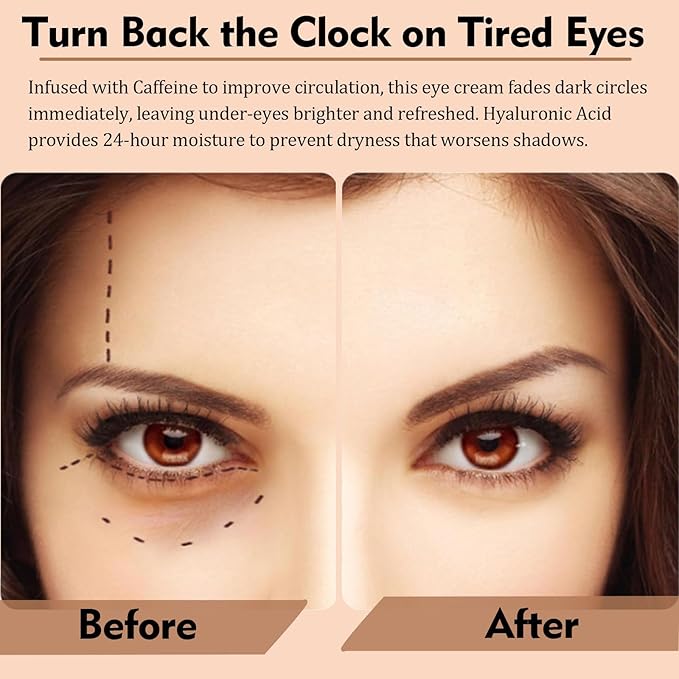 Temporary Instant Eye Tghtener Cream, Under Eye Cream For Dark Circles，Retinol Eye Cream Anti Aging，Under Eye Serum For Dark Circles And Puffiness For All Skin Types (Unscented)