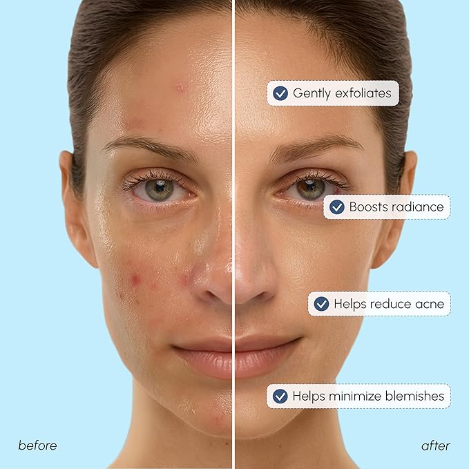 MAREE Toner Glycolic Acid Exfoliating Toner for Face 2 PACK Acido Glicolico para Manchas