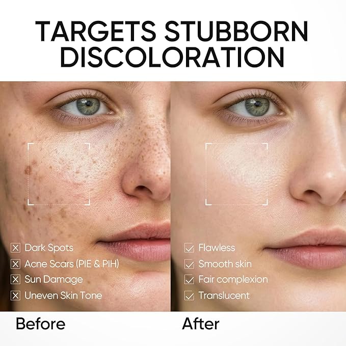 SKINTIFIC Dark Spot Moisture Cream, Brightening Moisturizer, Fades Dark Spots, Hyperpigmentation, 5X Ceramide Barrier Repair, 24H Hydration, Non-Greasy, 3.52 OZ (Pack of 1)