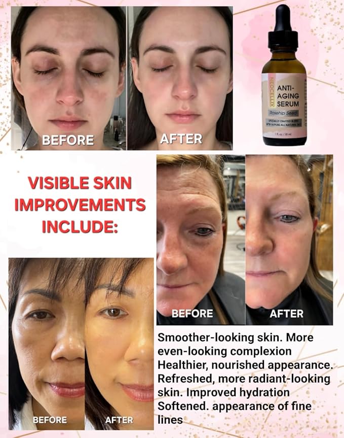 Anti-Aging Oil Serum – Made From 14 Pure All Natural Oils - Rosehip, Argan, Sea Buckthorn... Supports Smoother Texture, Firmness, Deep Hydration & Radiance Boost for Youthful Skin - Made in USA 1oz