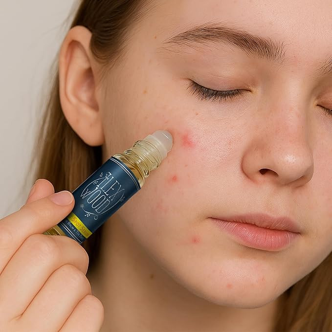 The Ilex Wood - Oblitzit - Spot Treatment Serum with Tea Tree and Lemon Balm, Natural Vegan Formula - 10ml (0.34 fl oz)