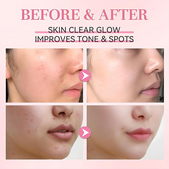 VP VibePro PDRN Pink Peptide Serum, Hydrating Facial Serum with Rose PDRN (Sodium DNA), 5-Type Peptide Complex & Hyaluronic Acid, Brightening & Firm-Looking, Korean Skincare, 30 ml