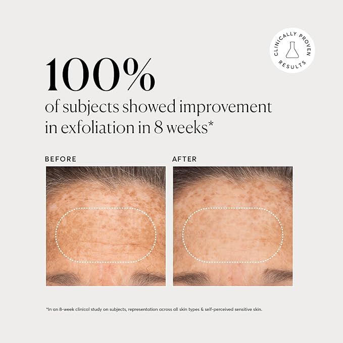 Naturium BHA Liquid Exfoliant 2%, Leave-on Face & Skin Care Exfoliating Pore Treatment, with Salicylic Acid & Bioactive Fruit Acids, Packaging May Vary, 4 oz