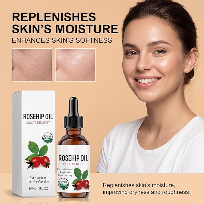 Rosehip Oil for Face, Rosehip Seed Oil, Organic Face Oil for Women, Hydrating Facial Oil for Daily Skincare, Nourishing Skin & Hair, Lightweight Moisturizing Oil (3PC)