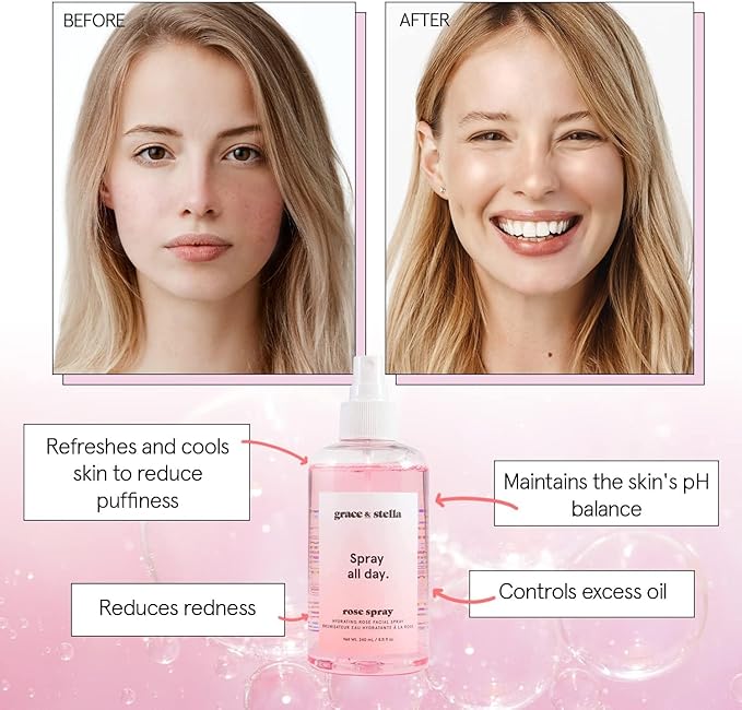 grace & stella Award Winning Rose Water Facial Spray (240ml) - Vegan - Rose Water Spray for Face - Rosewater Spray Toner Rose Hydrosol - Rose Spray Facial Mist - Rosewater Spray Toner Rose Hydrosol