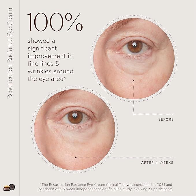 True Botanicals Resurrection Radiance Brightening Eye Cream | Reduces Appearance of Dark Circles, Fine Lines, Wrinkles & Puffiness | Dermatologist Tested, All Natural, Vegan| 0.5 oz | 15 ml