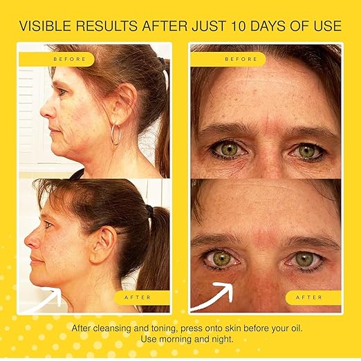 Jojoba Ultimate Serum – Face Serum with Jojoba Oil – Hydrating Formula for Smoother, Firmer-Looking Skin – Lightweight Daily Moisturizer for Fine Lines, Wrinkles & Uneven Texture – 30ml
