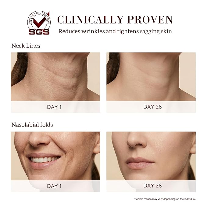 HKH Bakuchiol Retinol Serum For Face: 30 Caps Anti-Aging Serum for Sensitive Skin - SGS Tested to Reduce Wrinkles by 32.95% in 4 Weeks - 4 Plant-Based Vitamin A + Vitamin C - Travel-Friendly (Light)