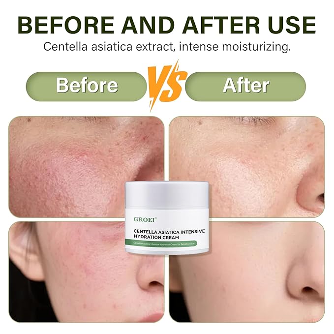 Centella Asiatica Intensive Hydration Cream, 85% Natural Ingredients, Long-Lasting Moisturizer for Sensitive & Dry Skin, Face Moisturizer Cream, 50g