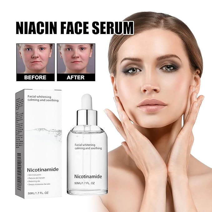 Generic Niacinamide Freckles Removal Serum, Sunnylas Niacinamide Freckles Removal Serum, Niacinamide Serum for Face and Body, Nicotinamide Serum for Blemishes, for All Type Skin (3PCS)