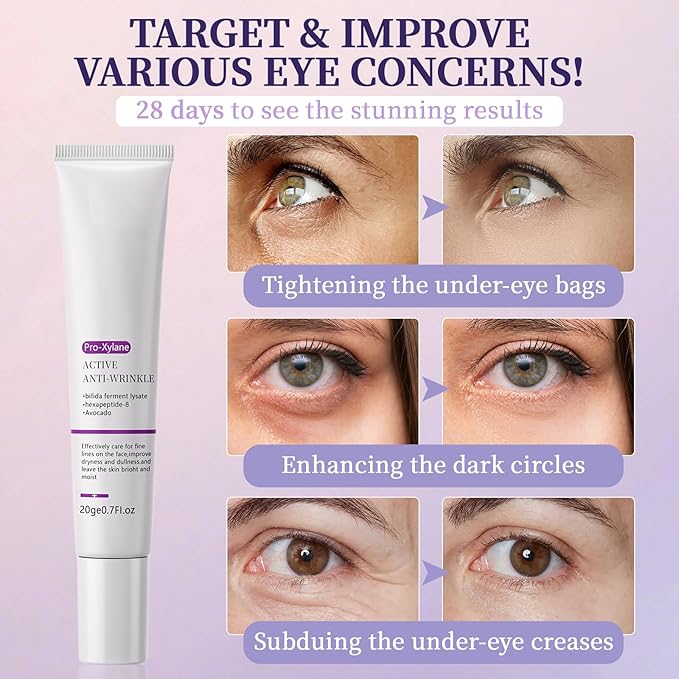 Retinol Eye Cream,Eye Serum for Dark Circles,5% Pro-Xylane Active Anti-Wrinkle Eye Cream,Dark Circles, and Fade Wrinkles, Fine Lines, Puffy eye Skin Care Treatment for Women and Men,0.7Oz