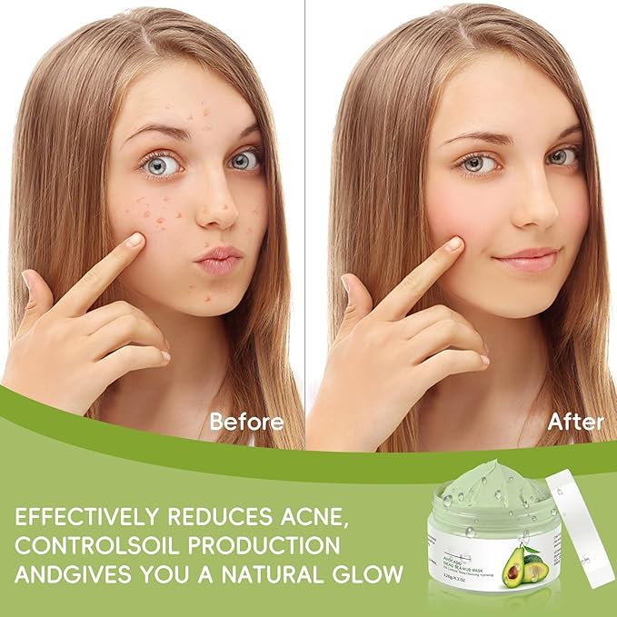 Clay Mud Face Mask for Women,Avocado Dead Sea Mud Facial Mask Skincare,Deeping Cleansing,Oil Control,Hydrating Face Cleaning Clay Masks for All Skin Types (4.2OZ)