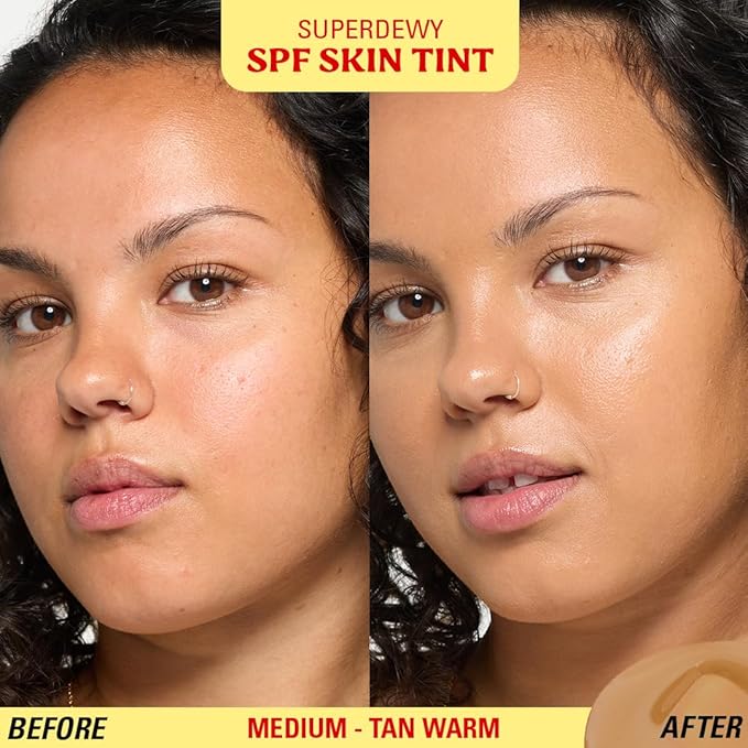 Revolution Superdewy SPF 30 Skin Tint, Tinted Mineral Face Foundation, Buildable Coverage for Facial Glow, 12% Zinc Oxide, Vegan & Cruelty-Free, Medium Tan Warm