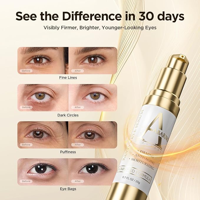 Hydrating Eye Serum for Dark Circles and Puffiness – Caffeine, Retinol, Niacinamide, Peptides – Anti-Wrinkle, Firming, Smooths Fine Lines – Under Eye Treatment – 0.7 fl. oz