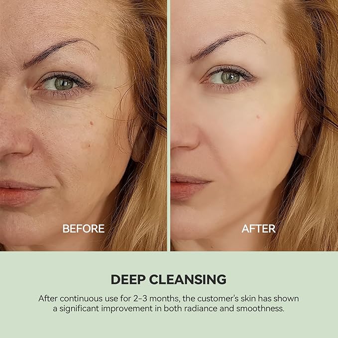 WNP Duo Cleansing Clay Mask with Niacinamide & Hyaluronic Acid – Deep Pore Cleanser for T-Zone & U-Zone, Blackhead Remover, Hydrating & Oil-Control Face Mask, 3.53oz (Pack of 2)