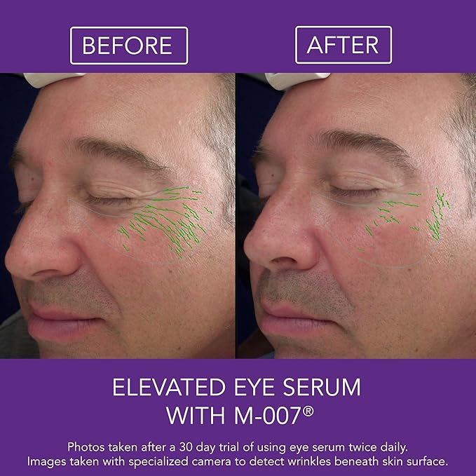 Omni Bioceuticals Elevated Eye Serum with Growth Factors and M-007® with 1 Refill - 15ml Serum with Additional 15ml Refill