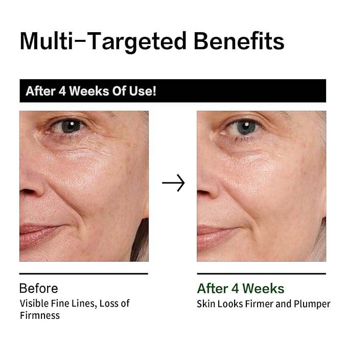 Retinol Serum for Face, Anti Aging Serum with Peptide for Fine Lines and Wrinkles, Smoothing, Repairing and Hydrating Face, 30ml (1 Fl Oz)