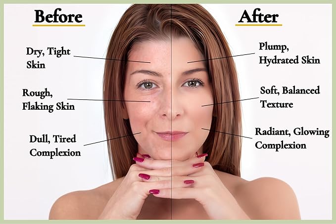 Moisturizing Face Mask For Dry Skin - Organic & Natural Skincare With Neem & Clay - Hydrates & Softens Skin - 100% Plant-Based, Cruelty-Free, Preservative-Free, & Eco-Friendly, 7 oz