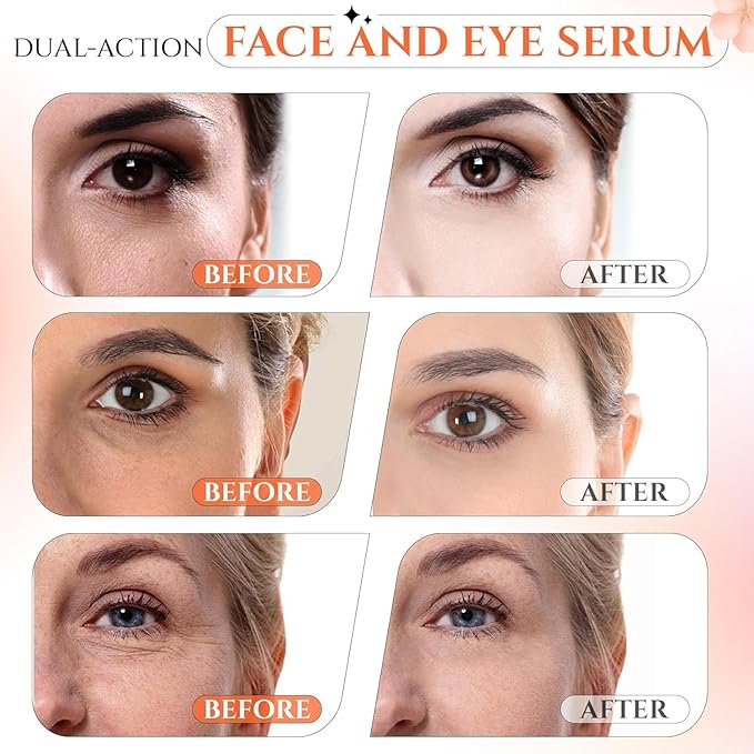 Ragkun 20% Vitamin C Serum, Retinol Serum for Face, Dark Spot Remover for Face, CE Ferulic Acid, Hyaluronic Acid, Hydrate & Plump Skin Care Anti Aging Wrinkle Brightening Skincare -1 Fl Oz.