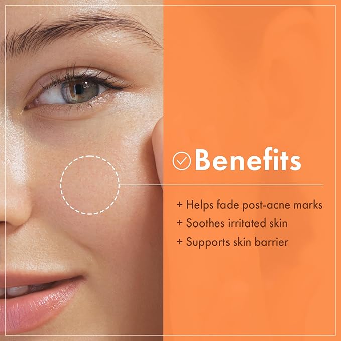 NATUREKIND Niacinamide Vitamin Ampoule - 20,000ppm Vitamin B3 Concentrated Serum, Panthenol, Hydrating, Fine Lines, Post Acne Marks, Uneven Skin Tone & Dull Skin, Korean Skin Care, 100ml, 3.38 fl.oz.