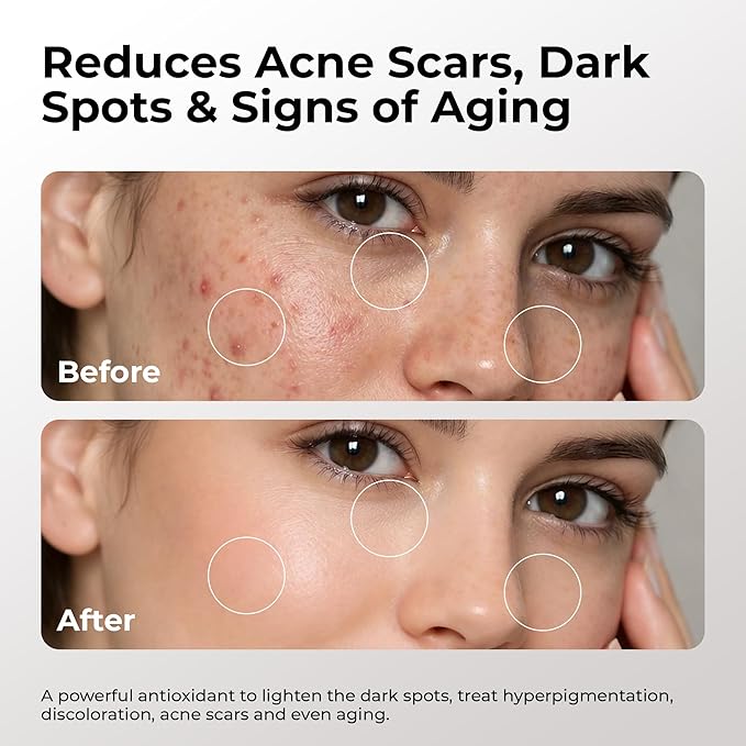 Skin Deva 20% Vitamin C Serum Anti Aging Face Serum with Hyaluronic Acid & Vitamin E – Brightening Formula for Improving Appearance of Dark Spots, Fine Lines & Wrinkles – All Skin Types, Pack of 2