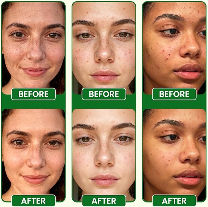 Lukaree Vitamin C Serum for Face – Brightening Vitamina C Facial Serum with Sodium Hyaluronate | Evens Skin Tone & Smooths Fine Lines | Antioxidant-Rich Beauty Product for All Skin Types,1 Fl Oz