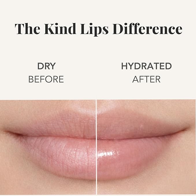 Kind Lips Unscented Lip Balm (5 Pack) – Fragrance Free, Organic & Hypoallergenic Lip Balm for Dry, Cracked Lips – Value Multipack for Daily Hydration