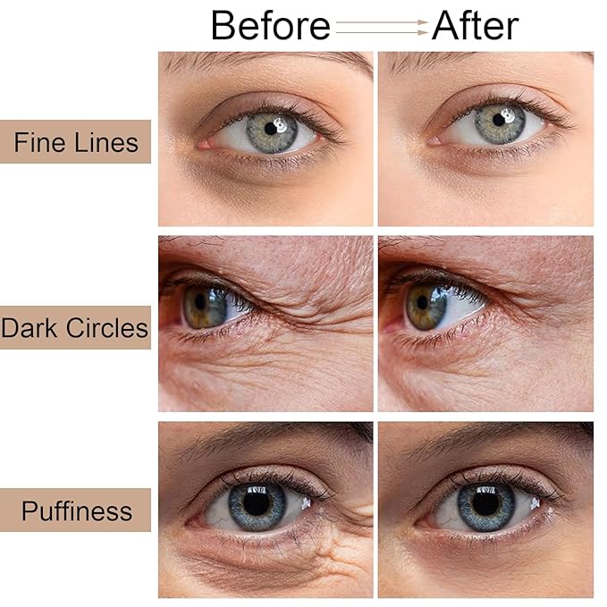 Caffeine Eye Cream Stick, Caffeine Eye Cream for Dark Circles Puffiness Wrinkles Hydrating Under Eye Stick Reduce Fine Lines Firming & Repair Skin 0.176oz/5g