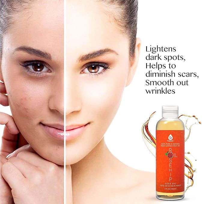 Pursonic 100% Pure Cold-Pressed Rosehip Oil – 6 FL oz Moisturizing Facial Oil for Face, Hair, Skin & Nails,Anti-Aging, Hydrating, Brightening, Scar & Stretch Mark Care - Pack of 1