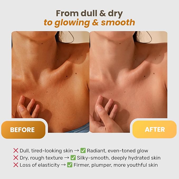 Clarimond Vitamin C Body Lotion w/Hyaluronic Acid & Collagen Peptides - Brightening Hydrating Moisturizer Non-Greasy for Dry, Sensitive Skin - Firming Tightening Body Cream