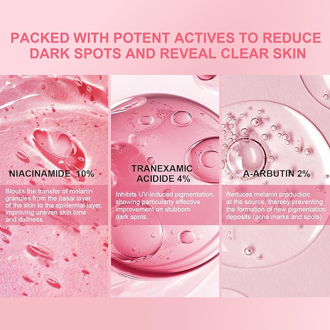 AVJONE Niacinamide 10 + TXA 4 Serum, Niacinamide Serum for Face – Glass Skin, Clarifying & Radiant Complexion, Vegan, Paraben-Free, Fragrance-Free, Cruelty-Free (30 ml / 1.01 fl. oz)