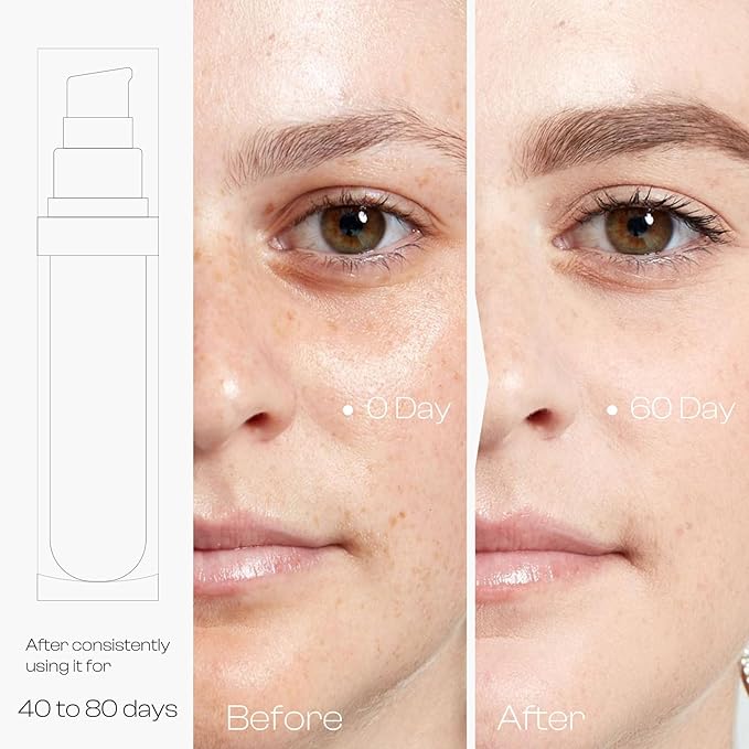 Vitamin C Face Serum: Skin Tone and Wrinkle Reduction - Nighttime Routine for Radiant Complexion in Fashion Women