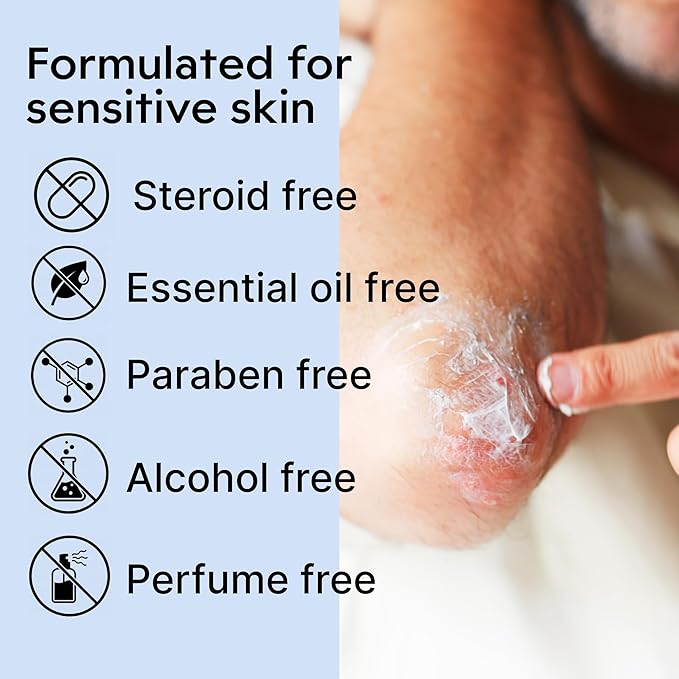 Clearbody Organics Manuka Honey Cream for Eczema & Dry Skin - Manuka Honey Ointment - Colloidal Oatmeal, Aloe & Natural Ingredients - Fast Relief Lotion for Reactive Skin - No Greasy Residue - 1 oz