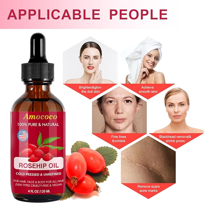 Organic Cold Pressed Rosehip Oil for Face, Natural Rose Hip Seed Oil, Nutrient Rich Facial Serum for Skin Care, Moisturize Dry Skin, 1 Fl Oz (30mL)