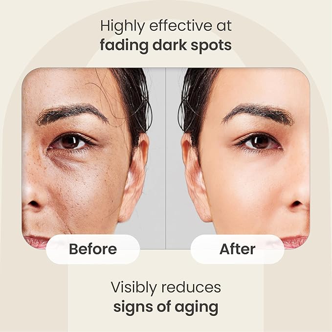 NSH Aloe & Hyaluronic Acid Face Serum 3.38 Fl oz – Ultra Hydrating, Anti-Aging & Anti-Acne Formula with Aloe, HA, Collagen, Elastin, Vitamin B5 & Vitamin E for Plumper, Clearer, Rejuvenated Skin