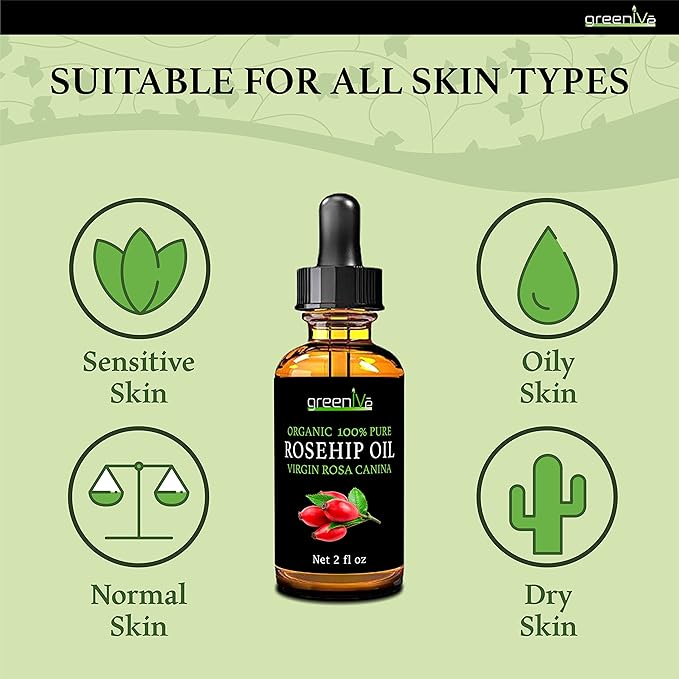 GreenIVe Rosehip Oil Rosa Canina 100% Pure Cold Pressed Virgin Oil Glass Dropper Easy Application (2 Fl Oz)
