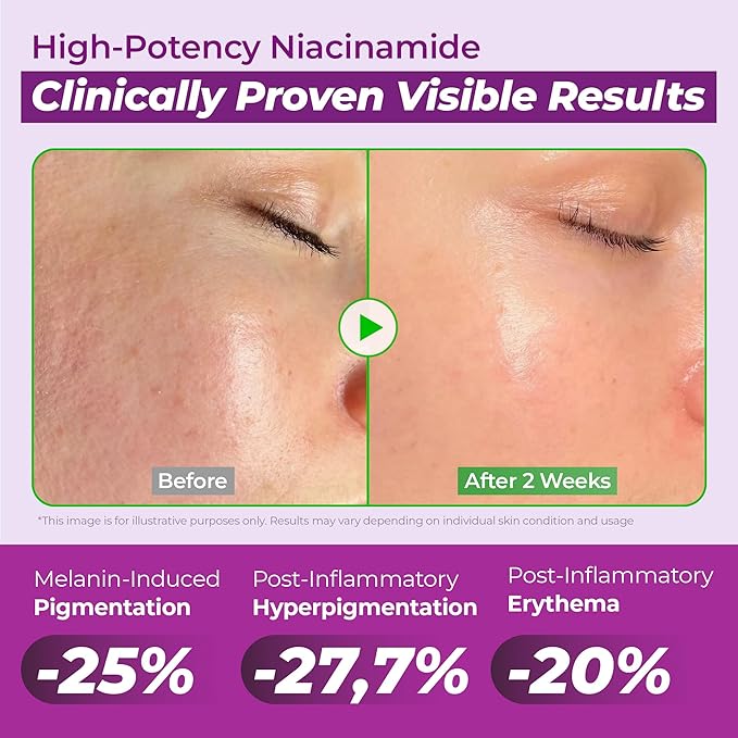 JUMISO Niacinamide 20 Serum - Korean Face Serum with Glutathione, TXA Tranexamic Acid and Centella Complex - Reduces Pigmentation, Uneven Skin Tone, Pore Care for Sensitive Skin, 1.35 fl.oz.
