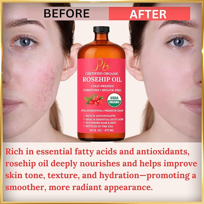 Rosehip Oil – USDA Organic 100% Pure, Cold-Pressed & Unrefined, Rosehip Oil for Face, Skin & Hair– Helps Reduce the Appearance of Fine Lines & Wrinkles – Rose Hip Seed Oil16 fl oz Glass Bottle