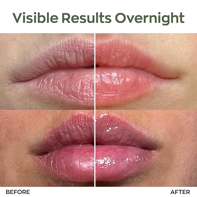 Elizabeth Mott Lip Sleeping Mask – Overnight Treatment with Peptides to Repair, Hydrate & Restore Dry, Chapped, Cracked, Peeling Lips – Moisturizing Collagen Balm to Soften, Smooth, Plump 0.71 oz