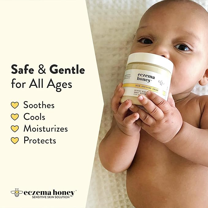 ECZEMA HONEY Original Skin-Soothing Cream - Organic Hand & Body Eczema Relief - Natural Honey Lotion for Dry, Itchy, & Irritable Skin (4 Oz) (Pack of 2)