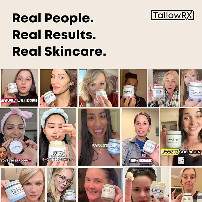TALLOWRX Tallow Body Lotion – 100% Grass-Fed Beef Tallow for Skin, Face & Body – Pure & Organic Moisturizer with Jojoba Oil, Vitamin E (8 Fl Oz, Vanilla)