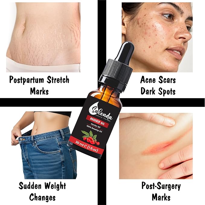 Rosehip Oil for Face, Cold Pressed Rose Hip Seed Oil, Carrier Oil for Skin-1 Fl Oz (30 ml)