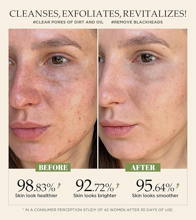 Revitalizing Exfoliation Face Scrub with Vitamin C and Turmeric – Gentle Exfoliating Face Wash for Blackheads, Pore Dirt & Dark Spots –Daily Balancing Facial Scrub for All Skin Types, 4.23 Fl Oz