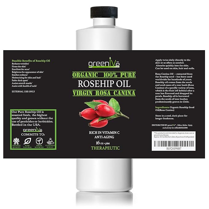 GreenIVe Organically Grown Rosehip Oil Rosa Canina 100% Pure Cold Pressed Virgin Oil Natural (16 Fl Oz)