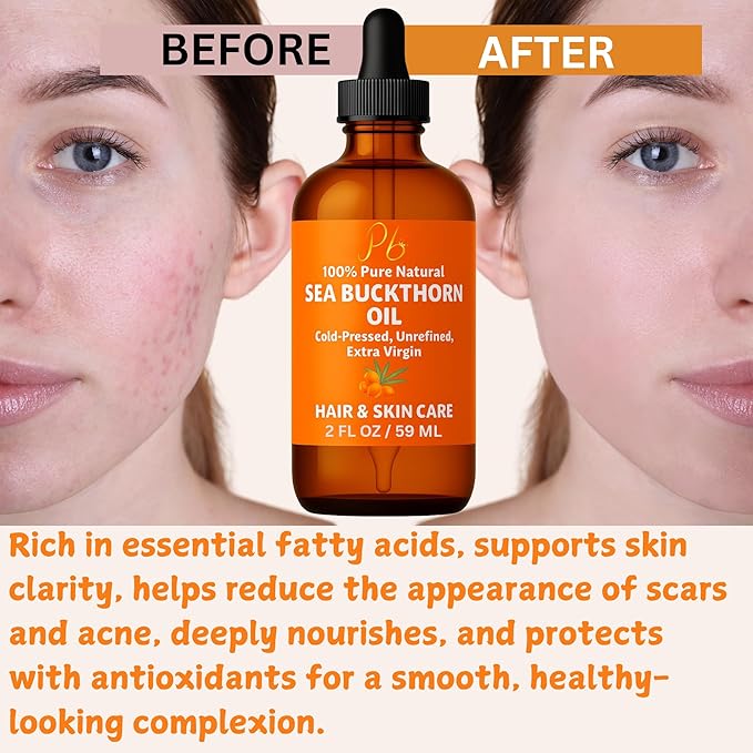 Pomberries Sea Buckthorn Oil – 100% Pure Cold-Pressed from Fruit & Seed – Sea Buckthorn Seed Oil for Face, Hair, Skin & Nails – Supports Radiant, Youthful-Looking Skin – Amber Glass Bottle 2 fl oz