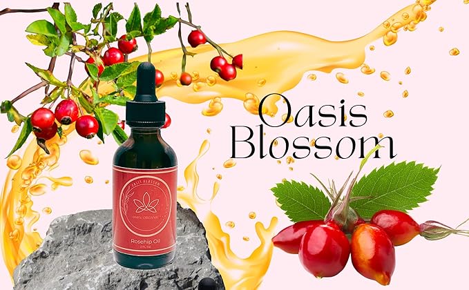 Rosehip Oil for Face, Skin & Hair| 100% Pure Certified USDA Organic | Cold Pressed Unrefined Rosehip Oil | Hydrating, Moisturizing, Nourishing, Anti-Aging | 2 Fl Oz.
