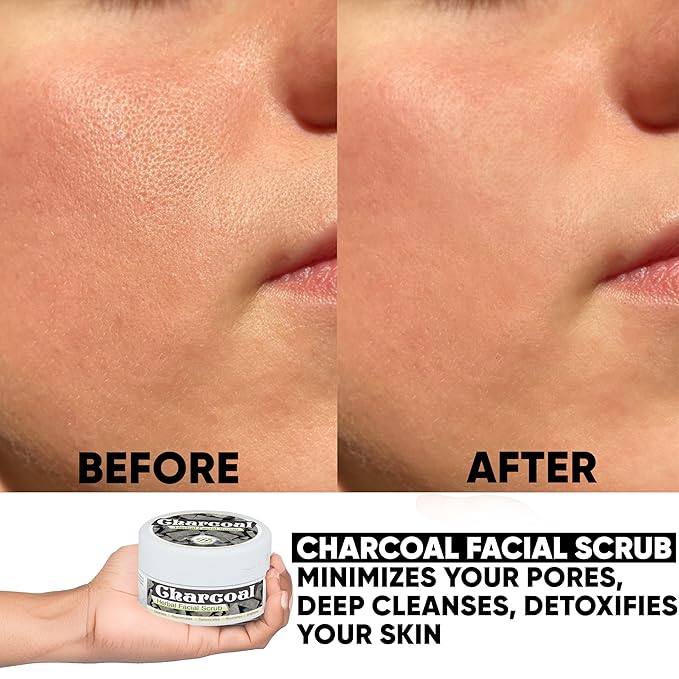 HERBOGANIC Charcoal Herbal Facial Scrub | Natural Body Scrub | Activated Charcoal Face Scrub for Women & Men | Exfoliant Scrub | Natural Facial Scrub | Equally Effective for Men and Women | 5.30 oz…